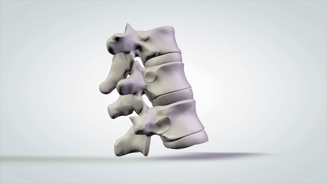 spinal injury in cervical osteochondrosis